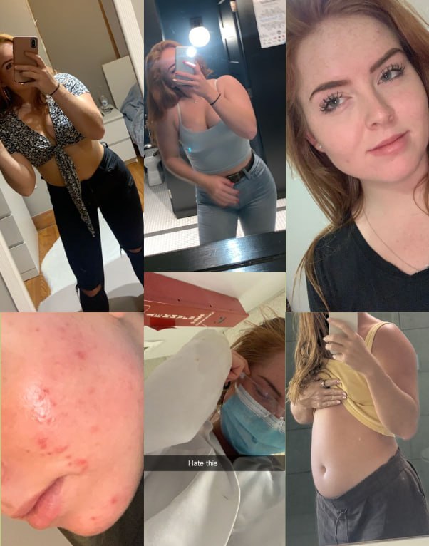 Amanda before - struggling with symptoms