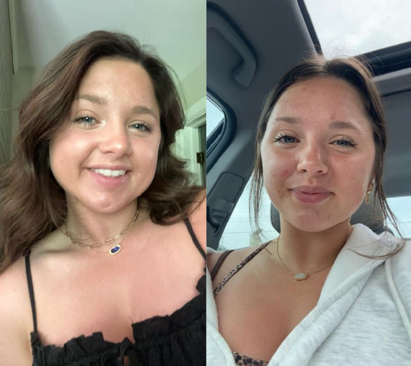 Lexi transformation